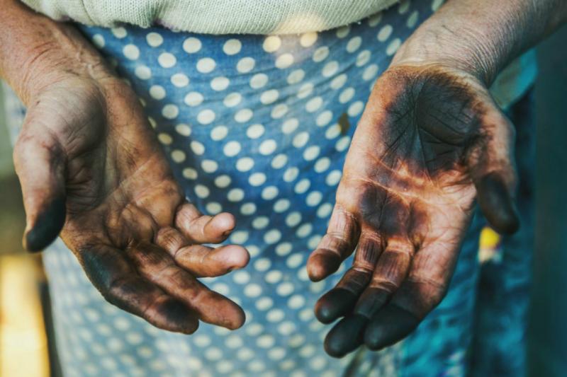 Taches de beurre sur les mains